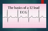 The basic’s of a 12 lead ECG - weds.heiw.wales · Performing an ECG Simple yet ‘personal’ test Proper skin prep Placement of the limb electrodes Placement of the chest electrodes