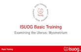 ISUOG Basic Training · Myoma Echogenicity. Basic TrainingEditable text hereBasic training • Shadowing Most common myometrial pathology - myoma Van Den Bosch et al, UOG, 2015, 46.