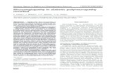 Microangiopathy in diabetic polyneuropathy revisited · Microangiopathy in diabetic polyneuropathy revisited 6459 in vivo showed increased epineurial shunt flow in patients with severe