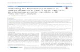Evaluating the biomechanical effects of implant diameter in case … · 2017-08-25 · implant diameter in case of facial trauma to an edentulous atrophic mandible: a 3D ... Mandible,