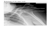 Xray of the Shoulder Anteroposterior projection LIMB... · PDF file Radiology of the upper limb Xray of the Shoulder Anteroposterior projection Glenoid fossa Spine of scapula Acromion