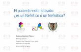 El paciente edematizado: ¿es un Nefrítico ó un Nefrótico? · 2020-05-29 · • Sindrome Nefrítico y Sindrome Nefrótico son dos entidades que se parecen pero no son iguales,