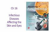 Ch 16 Infectious Diseases Affecting the Skin and Eyeslpc1.clpccd.cc.ca.us/LPC/Zingg/Micro/M_Lects_FS16/M _C_Ch16_FS… · 3. Diphtheroids: Corynebacterium, Propionibacterium •Also
