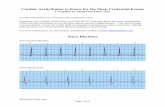 11 Cardiac Arrythmias to Trace ECG EKG - Sleep …...2018/11/11  · Cardiac arrhythmias are covered on the credential exams. Engaging your multiple senses helps you learn the ECG