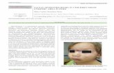 FACIAL SPOROTRICHOSIS IN CHILDREN FROM ...of sporotrichosis are lymphocutaneous sporotrichosis, fixed cutaneous (nodulopapular, ulcerative, verrucouse and furunculoide) and extracutaneous