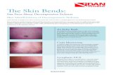 The Skin Bends - DAN DAN World · 2019-12-18 · The Skin Bends: Fast Facts About Decompression Sickness DANAP.ORG Skin Manifestations of Decompression Sickness A post-dive itch or