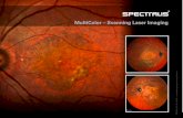 MultiColor ¢â‚¬â€œ Scanning Laser Imaging MultiColor Scanning Laser Imaging uses three laser wavelengths