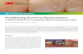 Simplifying Posterior Restorations · Simplifying Posterior Restorations: ... Figure 3: Bulk filling of the cavity and following final sculpting and curing HANDY HINT: Once the single