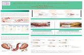 Hemolytic disease of the new born- Erythroblastosis Fetalis · PDF file Hemolytic disease of the new born- Erythroblastosis Fetalis. By Suman Khatri. Instructor: Prof. Christian Bach.