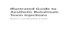 Illustrated Guide to Aesthetic Botulinum Toxin Injections › out › media › Illustrated_Guide_to... · 2 1 1.1 Introduction In its native form, botulinum toxin is a highly effective