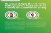 Placement of Alpha-Bio Tec's Narrow NeO Implant …...In 2015, Dr. Valenzuela received a Diploma in Digital Dentistry, Universidad de los Andes, Chile. He is the Clinical Director