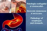 Болезни пищевода и желудка. · 2020-02-21 · Pathology of esophagus and stomach. Anomalii de dezvoltare a esofagului (atrezia esofagiană, fistule esofagotraheale).