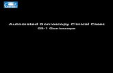Automated Gonioscopy Clinical CasesAutomated Gonioscopy Clinical Cases GS-1 Gonioscope GS-1_C01E001 * Image courtesy of Prof C. E. TRAVERSO, MD, Clinica Oculistica, Di.N.O.G.M.I.,