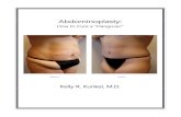 Abdominoplasty - Kelly R. Kunkel, M.D., P.A. 2019-09-20¢  Tummy tuck (abdominoplasty) surgery is very