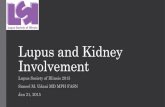 Lupus and Kidney Involvement Lupus and Kidney Involvement Lupus Society of Illinois 2015 ... regarding