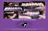 Tr Tannhelse - Norsk Terrier Klub1).pdf · 28 Informasjonshefte om Tenner Tannhelse Informasjonshefte om Tenner Tannhelse 29 Uregelmessig bitt/tannstilling Enkelte hunder krrrte hjør-tenner