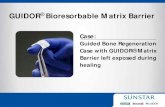GUIDOR Bioresorbable Matrix Barrier - Gumbrand · GUIDOR® Bioresorbable Matrix Barrier Case: ... (Yardley, PA) Extraction of the tooth and minimal flap reflection has been performed.