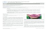 l c a l Derma Journal of Clinical & Experimental t i n o i ...€¦ · ulceration, mucosal tags, gingival enlargement, lingua plicata, facial palsy, facial swelling, and facial erythema