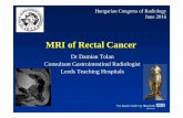 MRI of Rectal Cancer - PuzzlePix · MRI of Rectal Cancer Dr Damian Tolan Consultant Gastrointestinal Radiologist ... TNM stratifies benefit from neoadjuvant therapy What is the relevance
