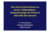 états précancéreux au cancer métastatique histopathologie de l…l3bichat2013-2014.weebly.com/uploads/1/3/9/0/13905422/... · 2019-09-21 · Les 4 phases de l’Histoire Naturelle