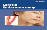 Carotid Endarterectomy (PDF) - Veterans Affairs › 2211665_VA.pdfcommon carotid arteries, each travel-ing up one side of the neck. Each artery divides into two branches. The internal