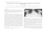 Platypnoea-orthodeoxia in cryptogenic fibrosing alveolitis · 2017-01-06 · fibrosing alveolitis and platypnoea-orthodeoxia. The exact mechanism of the physiological shunt is unclear