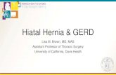 Hiatal Hernia & GERD - STS 1530. Brown. Hiatal... · Hiatal Hernia & GERD • 45 year old woman with hiatal hernia discovered during workup for heartburn • Her symptoms include
