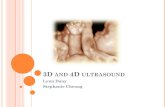 3D and 4D ultrasound - ece.mcmaster.ca€¦ · 2D TRANSDUCER ARRAY Grid of 128 x 128 transducer elements The more the better (better resolution) 20 x 20 in the 90’s Alignment of