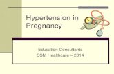 Hypertension in PregnancyPregnancy (2013) Hypertension in Pregnancy Hypertension is Defined as . . . Systolic blood pressure ≥ 140 mmHg or Diastolic blood pressure ≥ 90 mmHg Based