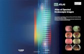 ATLAS Atlas of Spectral Endoscopic Images · Atlas of Spectral Endoscopic Images ATLAS SEG-086-00 FICE ATLAS case files ... endoscopy, I somewhat regretted having observed the gastrointestinal