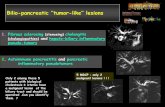 Bilio-pancreatic ‘’tumor like’’ · PDF file biliary obstruction presumed to be hilar or main bile duct malignant lesion are ultimately proved to have idiopathic benign stricture
