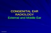 CONGENITAL EAR RADIOLOGY External and Middle Ear · The middle ear is undersized and disorganised. Normal basal cochlear turn. Left side normal. ... middle ear site and may preclude