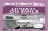 UPDATE ON SMILE - bmctoday.netbmctoday.net/crstodayeurope/pdfs/0914_supp.pdf · 2 SUPPLEMENT TO CATARACT & REFRACTIVE SURGERY TODAY EUROPESEPTEMBER 2014 PDATE ON SMILE This intrastromal