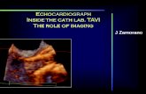 J Zamorano - congresso.caml-cardiologia.pt€¦ · Implant Results Pre- Indications Severe Aortic Stenosis Ao Valve area < 1cm² or 0,6 cm²/m² (Edwards Inc. AVA