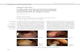 Imagen del mes Lesión solevantada de intestino delgado en …gastrolat.org/DOI/PDF/10.0716/gastrolat2015n100008.pdf · Los tumores benignos del intestino delgado repre-sentan algo