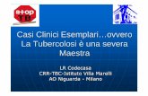 Casi Clinici Esemplari … ovvero La Tubercolosi è una ... · Casi Clinici Esemplari … ovvero La Tubercolosi è una severa Maestra LR Codecasa CRR-TBC-IstitutoVilla Marelli AO