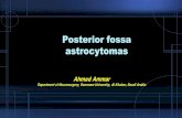 Posterior fossa astrocytomas€¦ · Posterior fossa astrocytomas Ahmed Ammar Department of Neurosurgery, Dammam University, Al Khobar, Saudi Arabia •Is it always benign?