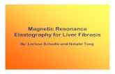 Magnetic Resonance Elastographyibruce/courses/EE3BA3... · 2 Outline • Introduction – Importance of Elasticity in Biological Tissues • Liver Disease • Ultrasound Elastography