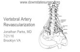 Vertebral Artery - SUNY Downstate Medical Center · 1) Hemodynamic source: >60% stenosis in both, or >60% unilateral if contralateral is hypoplastic, ends in PICA, or is occluded