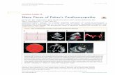 Many Faces of Fabry's Cardiomyopathy · IMAGING VIGNETTE Many Faces of Fabry’sCardiomyopathy Renuka Jain, MD, aLindsey Kalvin, RDCS, BS, Brandon Johnson, MD,b Lakshmi Muthukumar,