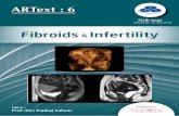 Fibroids Infertility - Indian Fertility Society · This common challenge in ART practice needs to be further simplified and understood. With this new edition of the ARText , We have