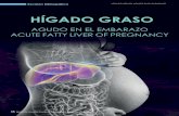 HÍGADO GRASO · Acute fatty liver is an exclusive disease of pregnancy characterized by microvesicular fatty infiltration of hepatocytes that can lead to fulminant liver failure
