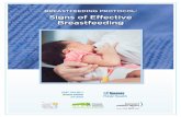 BREASTFEEDING PROTOCOL: Signs of Effective Breastfeeding · doing so, health care providers use their own professional judgement along with the evidence in assessing the care and