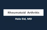 Rheumatoid Arthritis - Cooper University Hospital CME...2017/11/15  · Rheumatoid Arhtritis •High degree of disability, early mortality and morbidity •Mortality from severe RA