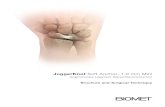 JuggerKnot Soft Anchor–1.0 mm Mini€¦ · Foot and Ankle Midfoot Reconstruction, Hallux valgus reconstruction Hand and Wrist Ulnar or lateral collateral ligament reconstruction,