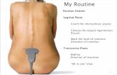 My Routine - Broome Docs€¦ · My Routine Sagittal Plane Count the interspinous spaces Choose the largest ligamentum ﬂavum Mark the level of insertion Direction of insertion Transverse