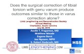 Does the surgical correction of tibial torsion with genu varum …llrs.org/LLRS 2016 PDFS/Does the surgical correction of tibial torsion... · – 32 external tibial torsion – 2