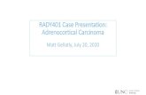 RADY401 Case Presentation: Adrenocortical Carcinoma · RADY401 Case Presentation: Adrenocortical Carcinoma. Patient History & Initial Work-up •Previously healthy 18 yo F presents