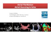 Atrial Fibrillation Atrial Stunning in Echo...DOI: 10.1016/j.echo.2004.04.021 New Insights Into the Predictors of Left Atrial Stunning After Successful Direct-Current Cardioversion