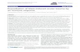 Exacerbation of blast-induced ocular trauma by an ... Ocular blast injury Blast wave exposure was performed as previously de-scribed [8]. Briefly, anesthetized mice were secured and